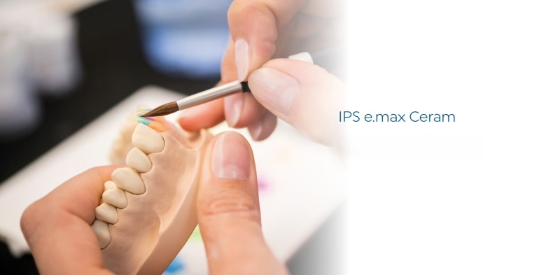 IPS e.max Ceram