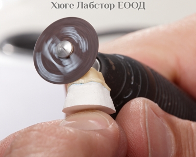 Сепаратор за керамика Renfert Dynex Brillant, 10бр.